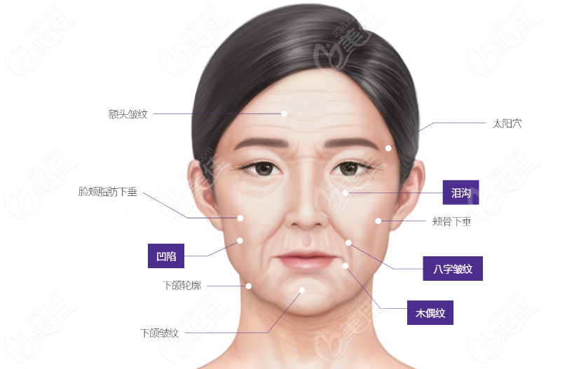 Wrinkle Treatment