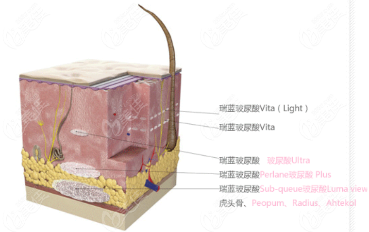 Injectable Procedure