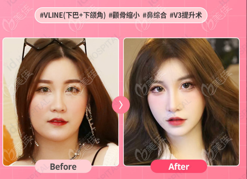 three-point contouring style