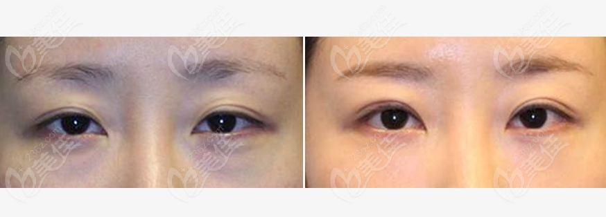 Comparison photo 1