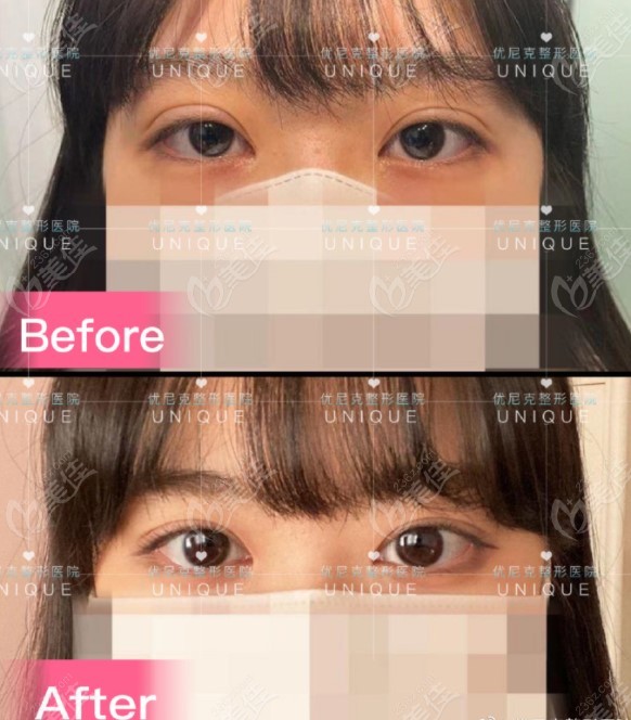  Eye Repair 