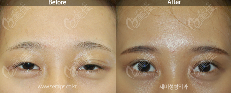 a unique eye design standard