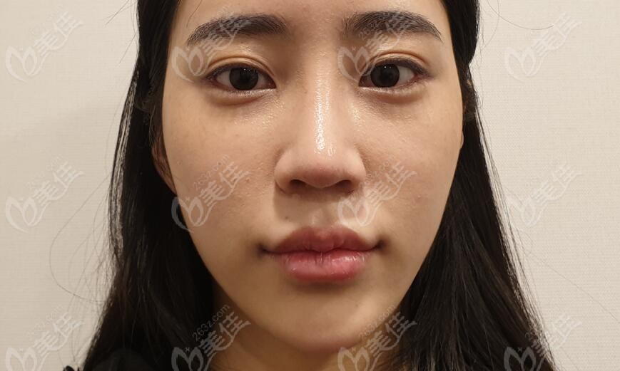 Surgical procedures