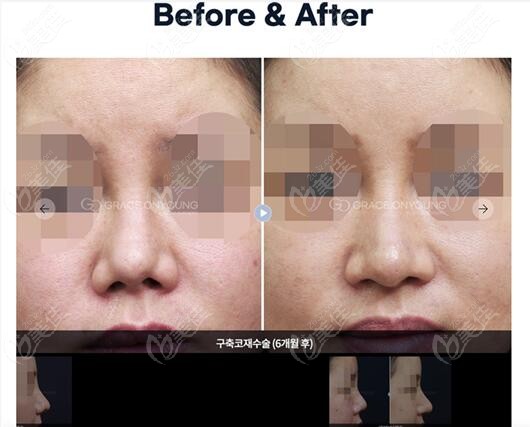real-life comparison photos