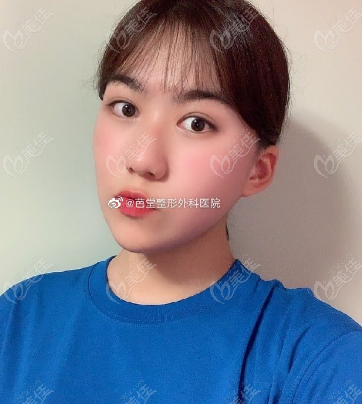 he patient's chin was relatively small
