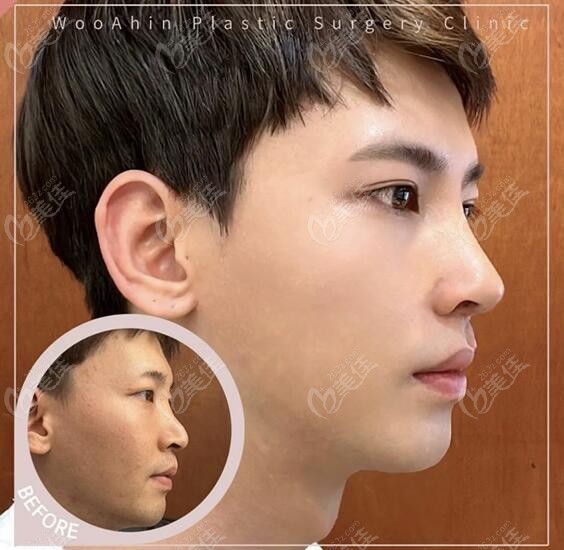  real-life comparison photos of men