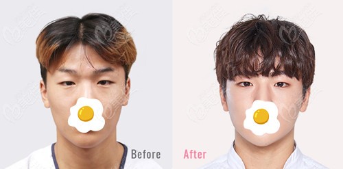Electric Eye Plastic Surgery
