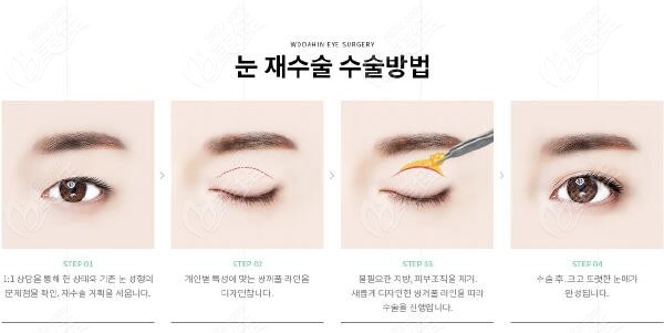 eye repair
