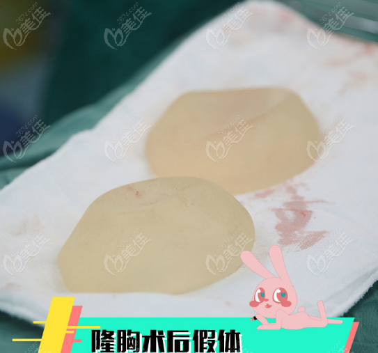 Breast Implant Repair