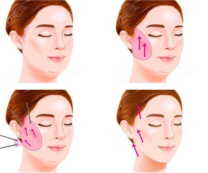 maintain anti-aging effects for over 5 years