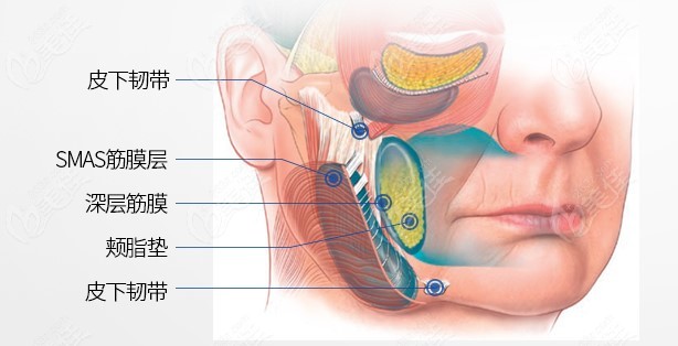 Multilayer restoration facial lifting surgery