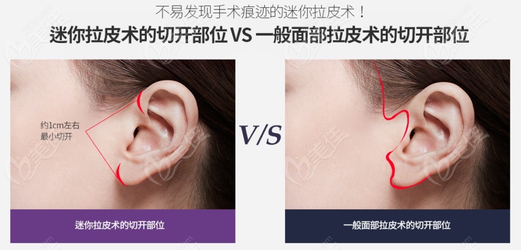 OPERA Plastic Surgery