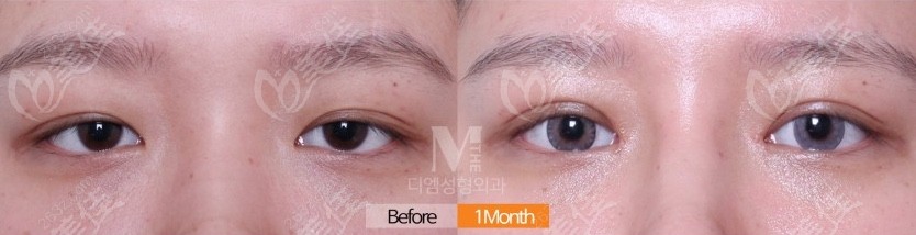 Customer Eye Repair Evaluations 
