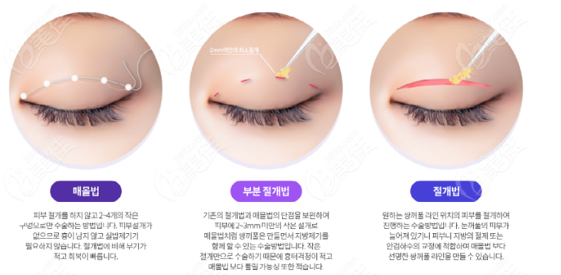 Eye Repair