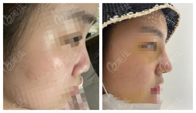 ONDO Plastic Surgery