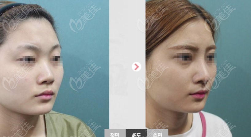 Will Plastic Surgery
