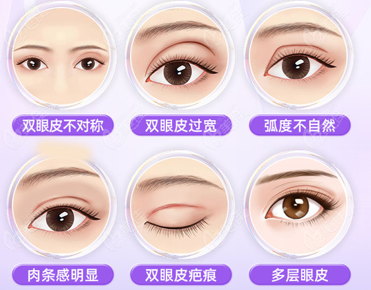 eyelid repair surgery 