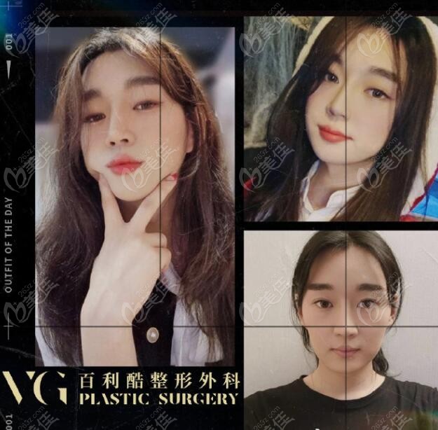 real-life comparison photos