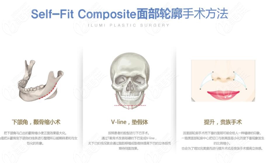 contouring surgeries