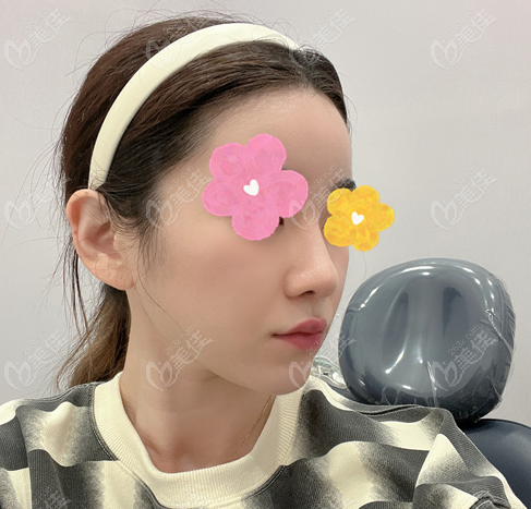Personal Experience of Contouring Procedure at VG Plastic Surgery