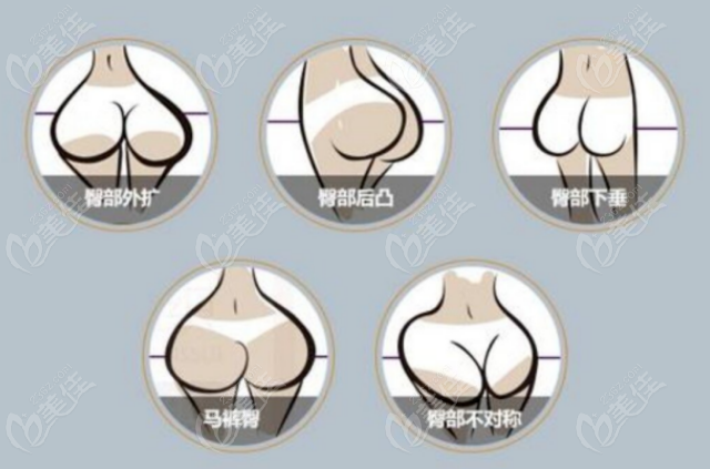 Which Hospitals in South Korea offer Brazilian Butt Lift? 